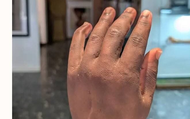 Nigerian inventor’s bionic arm named among TIME’s best inventions of 2026