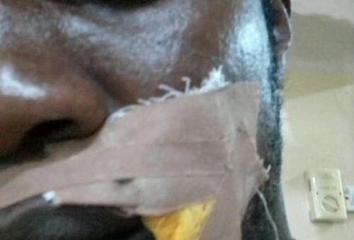 JUST IN: Suspected thugs attack Edo ADC campaign train