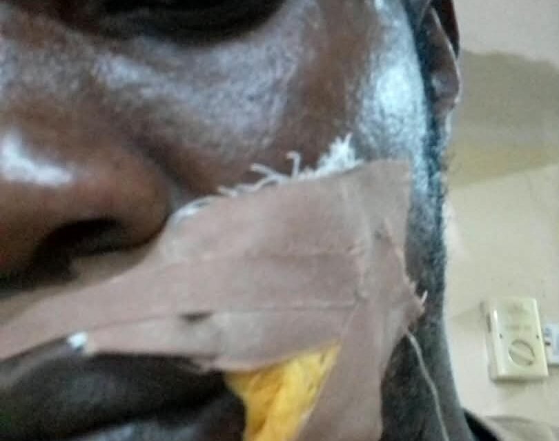 JUST IN: Suspected thugs attack Edo ADC campaign train JUST IN: Suspected thugs attack Edo ADC campaign train