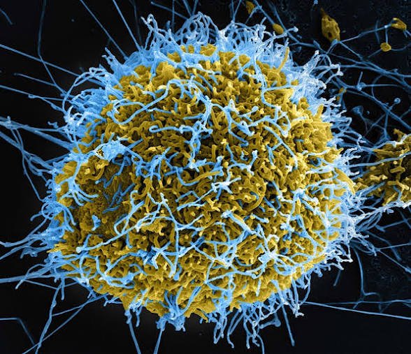 Ebola Patient’s Condition Worsens – NCDC